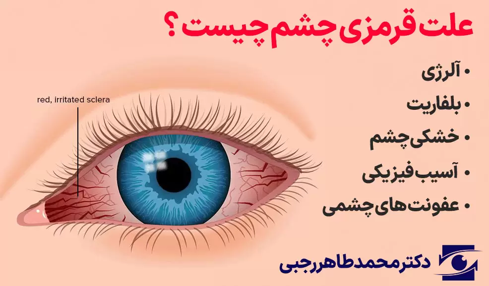 قرمزی چشم