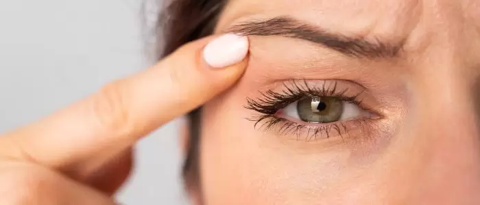 Eye pain after blepharoplasty