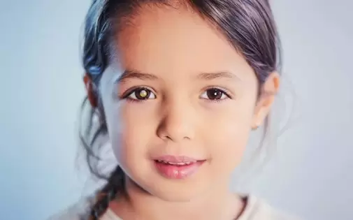 درمان رتینوبلاستوما