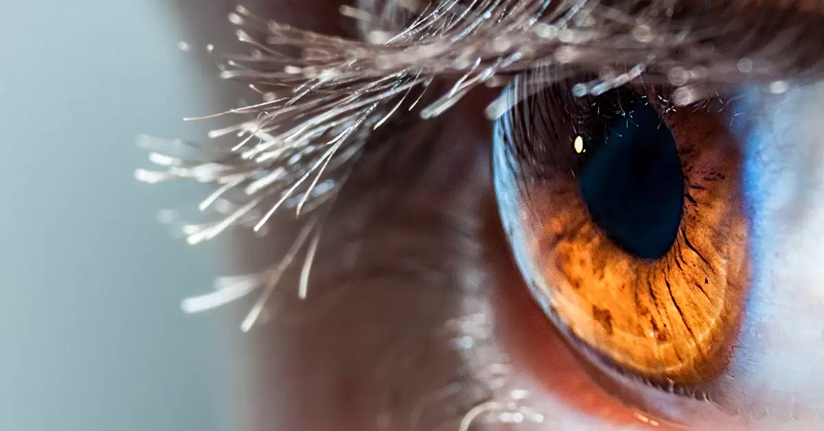 بهترین جراح تومورهای چشمی