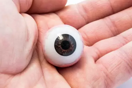 کارگذاری پروتز چشم