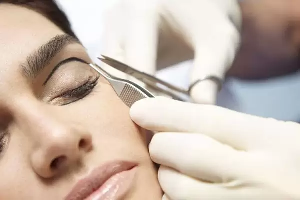 اهداف عمل ترمیمی پلک